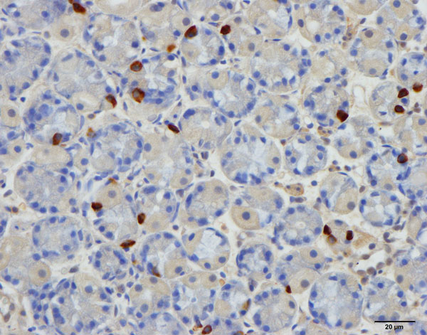 Figur 2 B. Ghrelin-immunoreaktive celler i magesekkens corpusslimhinne hos en pasient med IBS-D.
