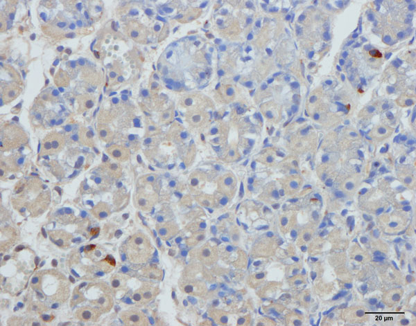 Figur 2 C. Ghrelin-immunoreaktive celler i magesekkens corpusslimhinne hos en pasient med IBS-C.