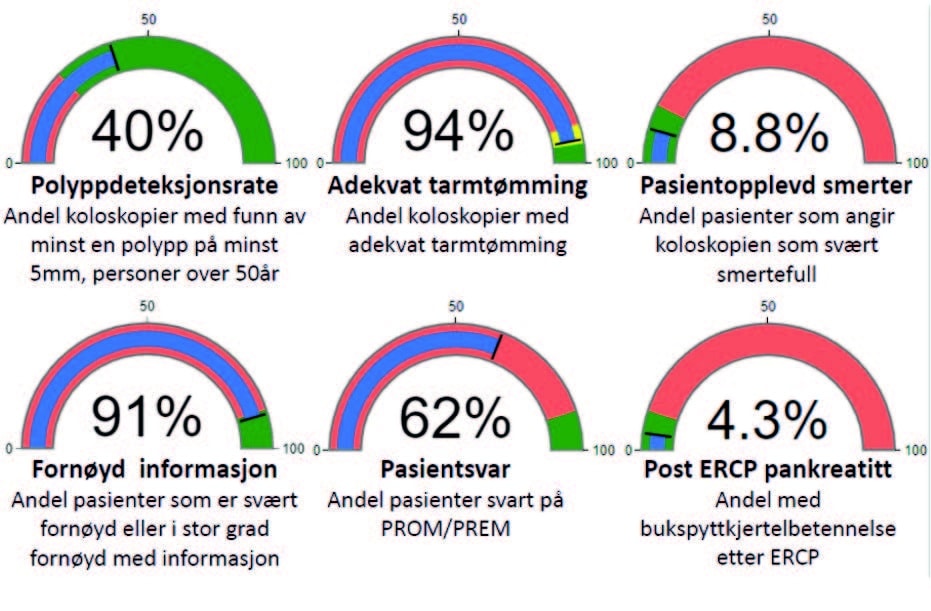 NGF-nytt 1-2025-51-F1 - Gastroenterologen